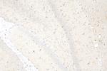 IBA1 Antibody in Immunohistochemistry (Paraffin) (IHC (P))