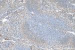 IBA1 Antibody in Immunohistochemistry (Paraffin) (IHC (P))
