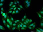 BANF1 Antibody in Immunocytochemistry (ICC/IF)
