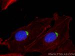 PI16 Antibody in Immunocytochemistry (ICC/IF)