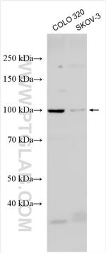 PI16 Antibody in Western Blot (WB)