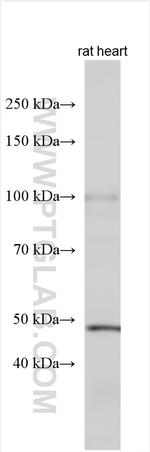 PI16 Antibody in Western Blot (WB)