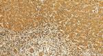 GSDMD Antibody in Immunohistochemistry (Paraffin) (IHC (P))