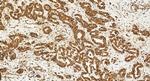 GSDMD Antibody in Immunohistochemistry (Paraffin) (IHC (P))