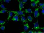 SIPA1L3 Antibody in Immunocytochemistry (ICC/IF)