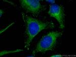 SIPA1L3 Antibody in Immunocytochemistry (ICC/IF)