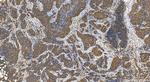 SIPA1L3 Antibody in Immunohistochemistry (Paraffin) (IHC (P))