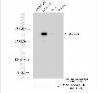 SIPA1L3 Antibody in Immunoprecipitation (IP)