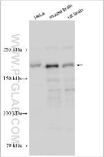 SIPA1L3 Antibody in Western Blot (WB)