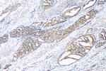 MTA1 Antibody in Immunohistochemistry (Paraffin) (IHC (P))