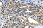 MTA1 Antibody in Immunohistochemistry (Paraffin) (IHC (P))