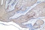 MTA1 Antibody in Immunohistochemistry (Paraffin) (IHC (P))