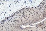 MTA1 Antibody in Immunohistochemistry (Paraffin) (IHC (P))