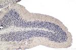MTA1 Antibody in Immunohistochemistry (Paraffin) (IHC (P))