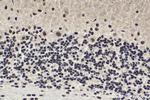 MTA1 Antibody in Immunohistochemistry (Paraffin) (IHC (P))