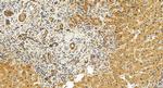 AKAP11 Antibody in Immunohistochemistry (Paraffin) (IHC (P))