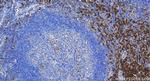 SLAMF7/CD319 Antibody in Immunohistochemistry (Paraffin) (IHC (P))