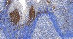 SLAMF7/CD319 Antibody in Immunohistochemistry (Paraffin) (IHC (P))