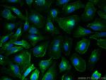 CD71 Antibody in Immunocytochemistry (ICC/IF)