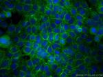 CD71 Antibody in Immunocytochemistry (ICC/IF)