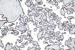 CD71 Antibody in Immunohistochemistry (Paraffin) (IHC (P))