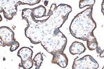 CD71 Antibody in Immunohistochemistry (Paraffin) (IHC (P))
