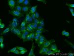 gp130/IL6ST Antibody in Immunocytochemistry (ICC/IF)
