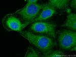 Mmp9 Antibody in Immunocytochemistry (ICC/IF)