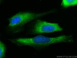 Mmp9 Antibody in Immunocytochemistry (ICC/IF)