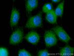 IGFBP3 Antibody in Immunocytochemistry (ICC/IF)