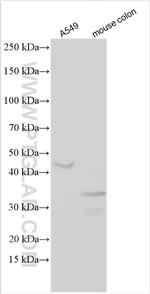 IGFBP3 Antibody in Western Blot (WB)