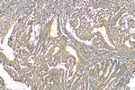 VCAN Antibody in Immunohistochemistry (Paraffin) (IHC (P))