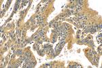 VCAN Antibody in Immunohistochemistry (Paraffin) (IHC (P))
