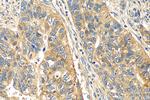 VCAN Antibody in Immunohistochemistry (Paraffin) (IHC (P))