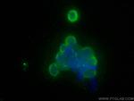 Fas/CD95 Antibody in Immunocytochemistry (ICC/IF)