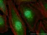 EYA2 Antibody in Immunocytochemistry (ICC/IF)