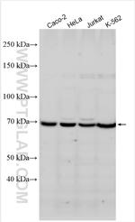 BMPR1A Antibody in Western Blot (WB)