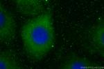 MMP11 Antibody in Immunocytochemistry (ICC/IF)