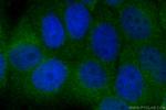 MMP11 Antibody in Immunocytochemistry (ICC/IF)