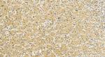 MLPH Antibody in Immunohistochemistry (Paraffin) (IHC (P))