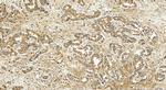 MLPH Antibody in Immunohistochemistry (Paraffin) (IHC (P))