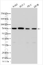 CACNA1B Antibody in Western Blot (WB)