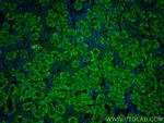 LAPTM4A Antibody in Immunohistochemistry (PFA fixed) (IHC (PFA))