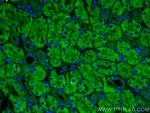 LAPTM4A Antibody in Immunohistochemistry (PFA fixed) (IHC (PFA))