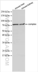LAPTM4A Antibody in Western Blot (WB)