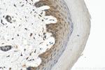 NOD2 Antibody in Immunohistochemistry (Paraffin) (IHC (P))