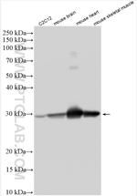 SLC25A4 Antibody in Western Blot (WB)