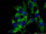 RAB8A Antibody in Immunocytochemistry (ICC/IF)