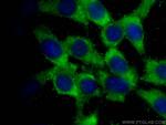 RAB8A Antibody in Immunocytochemistry (ICC/IF)
