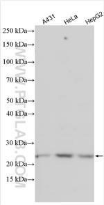 RAB8A Antibody in Western Blot (WB)